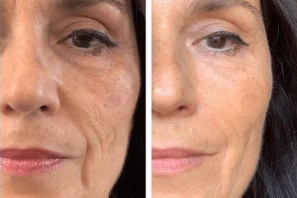 Lee más sobre el artículo Cómo aplicar el Kit Anti Edad de Afrodita